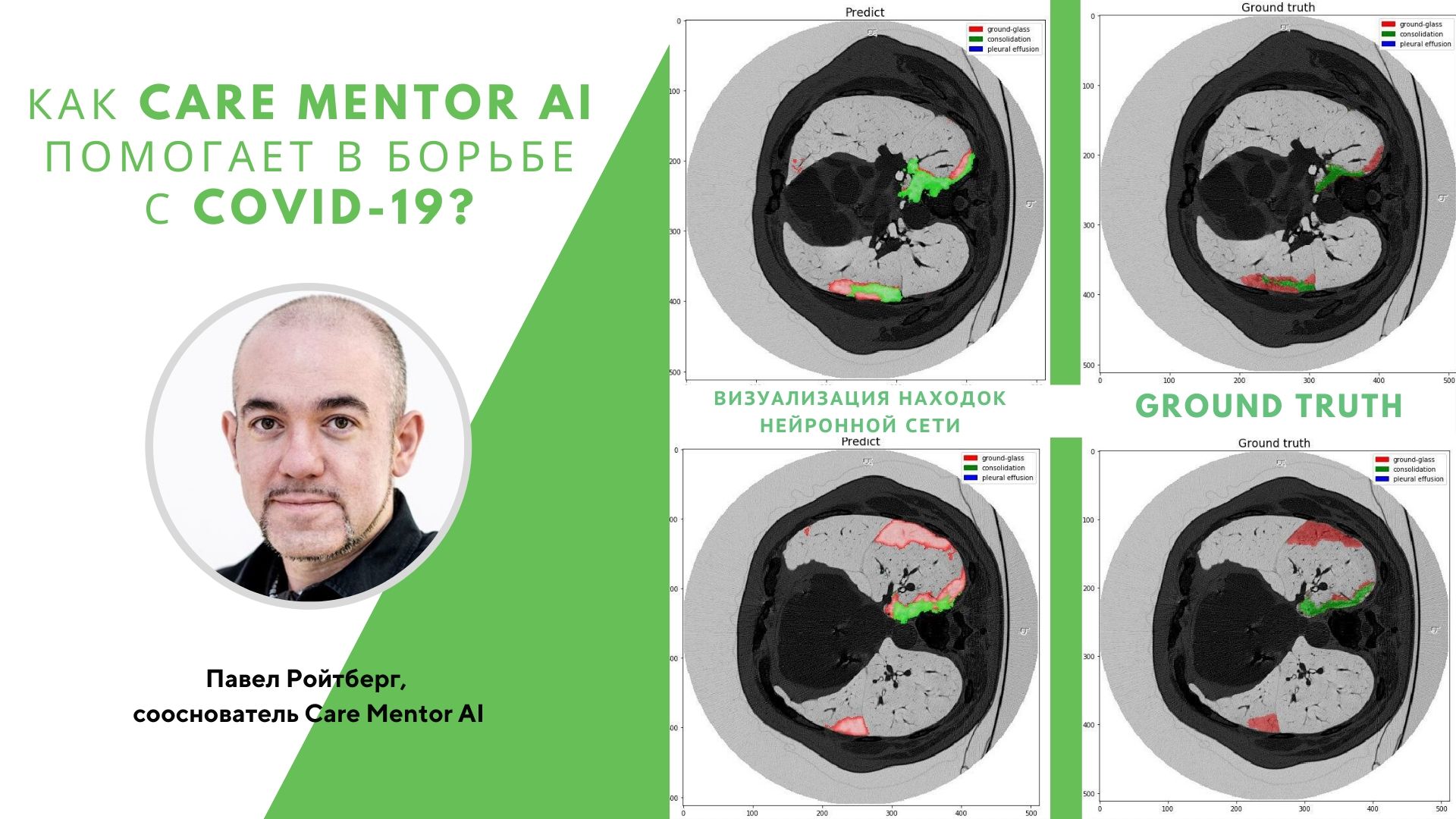 Care Mentor AI сообщает о прогрессе в создании нейросети для обнаружения COVID-19 на КТ исследованиях
